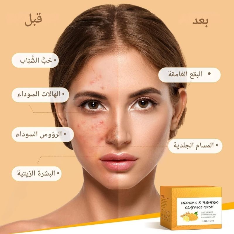 قناع الطين بالكركم وفيتامين C – لتنظيف المسام وترطيب البشرة